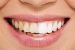 Cosmetic Dentistry Dentist Albury Wodonga